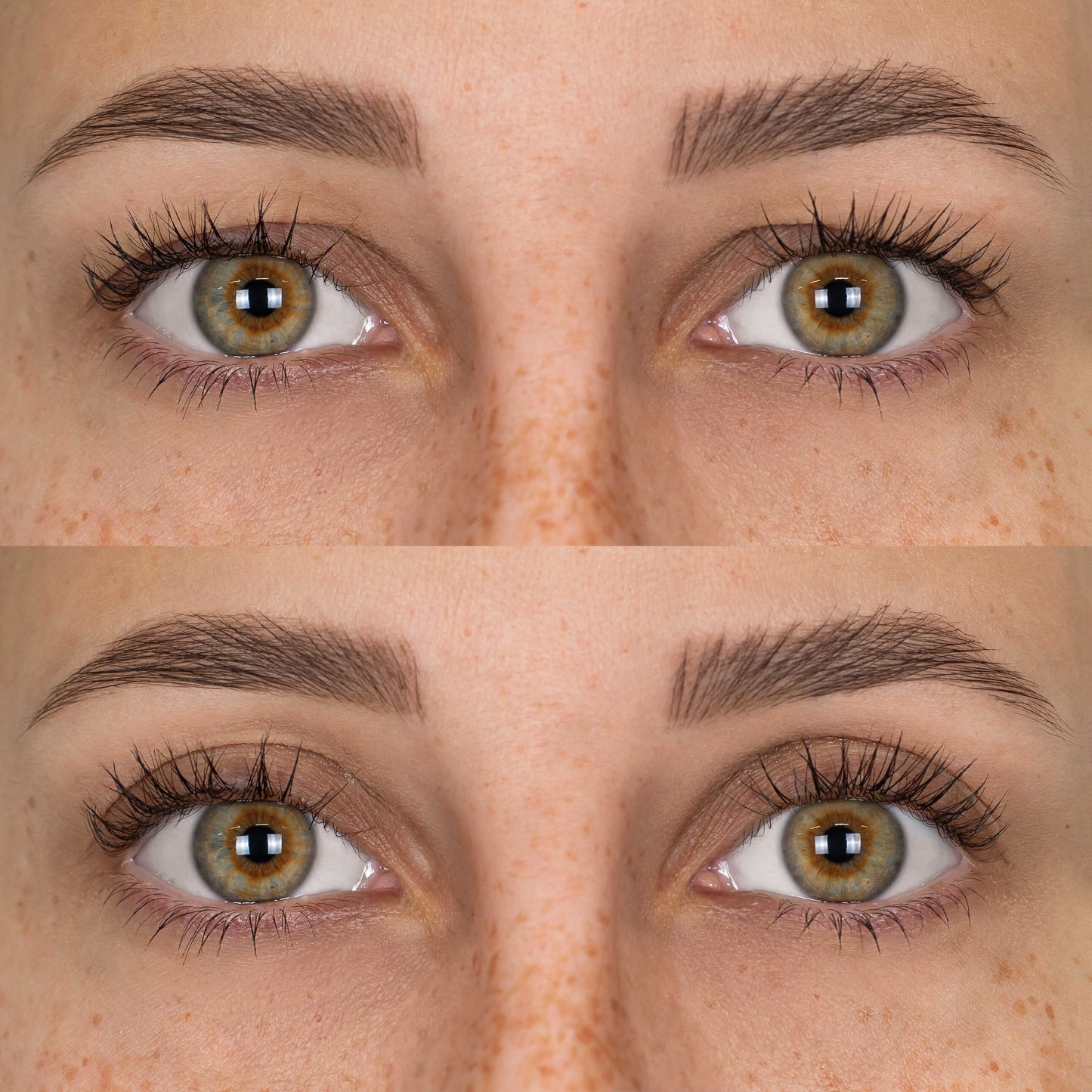 Patchs Lift Paupières